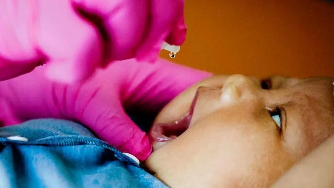 Indonesia Umumkan Kejadian Luar Biasa (KLB) Polio Berakhir